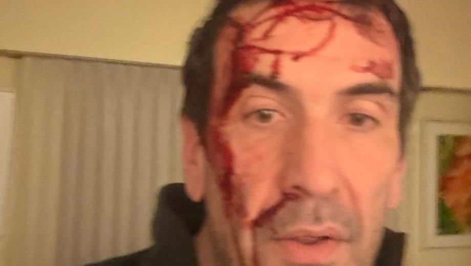 La imagen que se viralizó del diputado nacional y candidato a senador por La Libertad Avanza, Pablo Cervi. (Foto: gentileza)