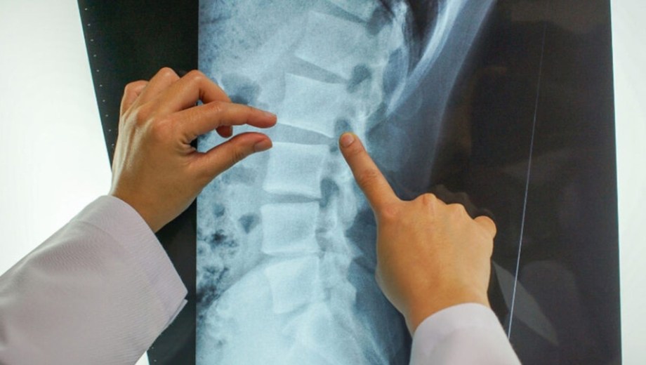 La Justicia de Neuquén determinó que las vibraciones y malas condiciones laborales deterioraron su columna. Foto Ilustrativa.
