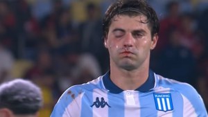 Sosa sufrió una fractura en la cara tras el golpe involuntario de Rojo en la semifinal con Flamengo