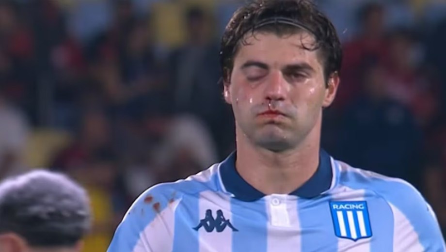 El rostro de Sosa tras el golpe sufrido en el partido ante Flamengo.