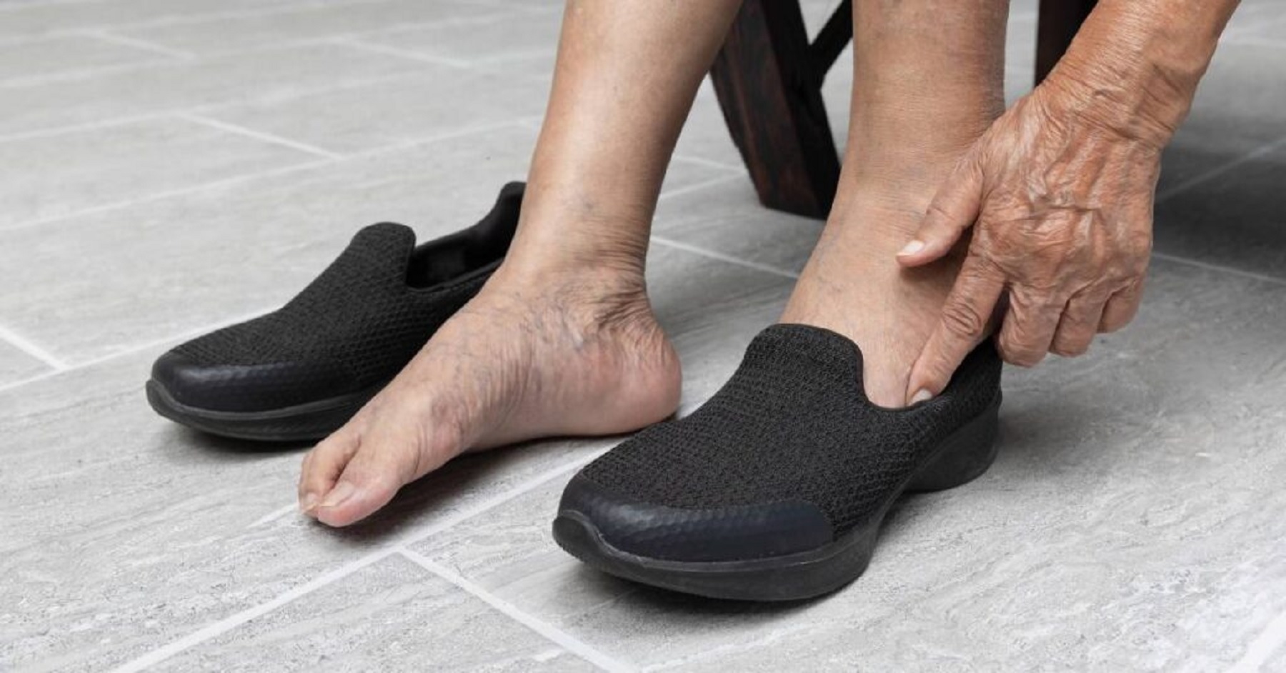 Qué tipo de calzado es más recomendable para prevenir las várices y cuidar la circulación de las piernas