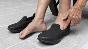 Qué tipo de calzado es más recomendable para prevenir las várices y cuidar la circulación de las piernas