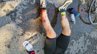 Preocupan los ataques reiterados de perros a ciclistas entre Allen y Guerrico: «Me sacaba uno de encima, me mordía otro»