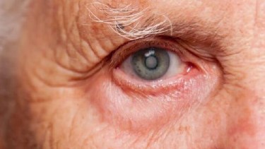 Los alimentos ricos en vitaminas A, C y E que protegen tus ojos de cataratas, la radiación UV y el envejecimiento