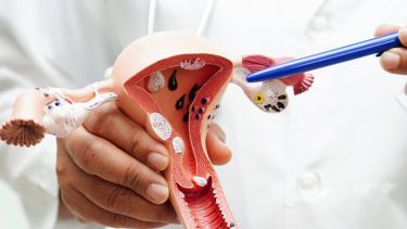 Día Mundial de Cáncer de cuello uterino: una enfermedad prevenible que causa más de 2.200 muertes