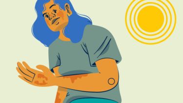 Día Mundial del Lupus: la enfermedad que ataca el cuerpo y que el 58% del mundo apenas conoce
