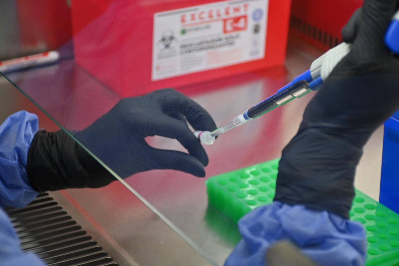 Desarrollan el primer test rápido para detectar el hantavirus Andes en Patagonia
