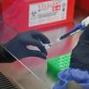 Imagen de Crean el primer test rápido del mundo para detectar la cepa Andes del hantavirus de la Patagonia