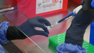 Crean el primer test rápido del mundo para detectar la cepa Andes del hantavirus de la Patagonia