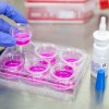 Imagen de Hantavirus: investigan un spray nasal que podría prevenir contagios de la cepa Andes