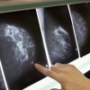 Imagen de Mucho antes de octubre: la estrategia de Neuquén para detectar a tiempo la principal causa de muerte por cáncer en mujeres