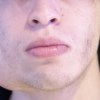 Imagen de "El tumor sigue rompiendo todo": un joven de Neuquén necesita una cirugía de 20 mil dólares