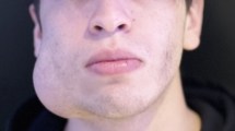 Imagen de «El tumor sigue rompiendo todo»: un joven de Neuquén necesita una cirugía de 20 mil dólares