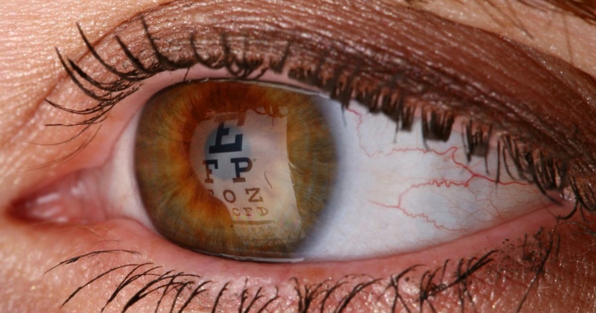 Oftalmólogos argentinos recibieron una distinción internacional por una técnica innovadora en cirugía de retina