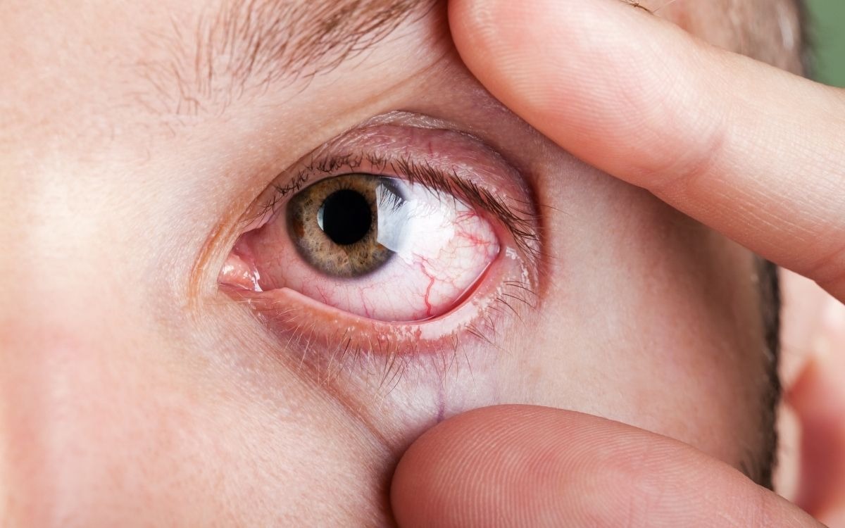 La calefacción puede dañar tus ojos en invierno: por qué aumentan los casos de ojo seco