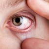 Imagen de La calefacción puede dañar tus ojos en invierno: por qué aumentan los casos de ojo seco