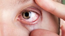 Imagen de La calefacción puede dañar tus ojos en invierno: por qué aumentan los casos de ojo seco