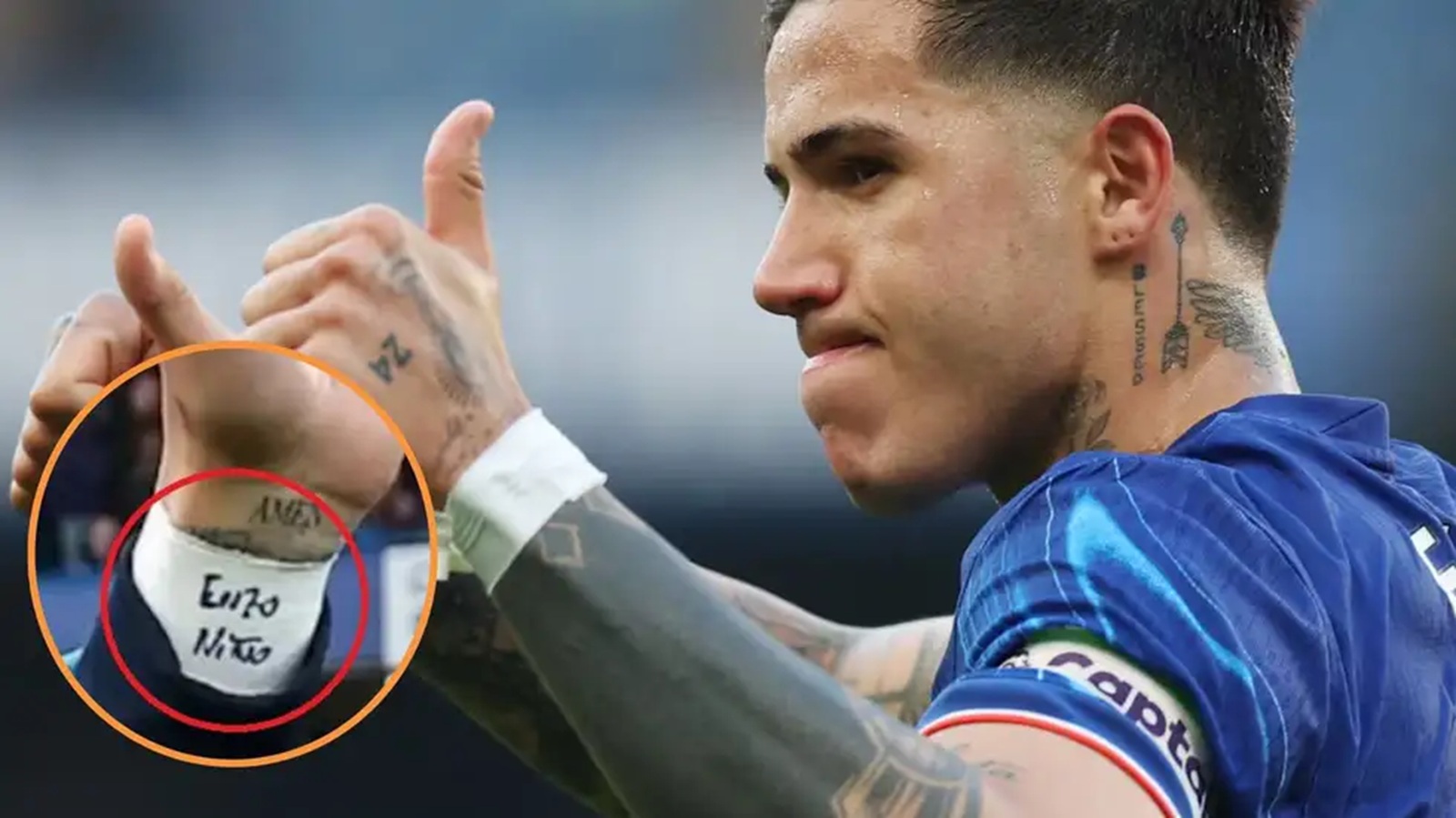 La historia detrás de las vendas de Enzo Fernández: la frase «Enzo niño»