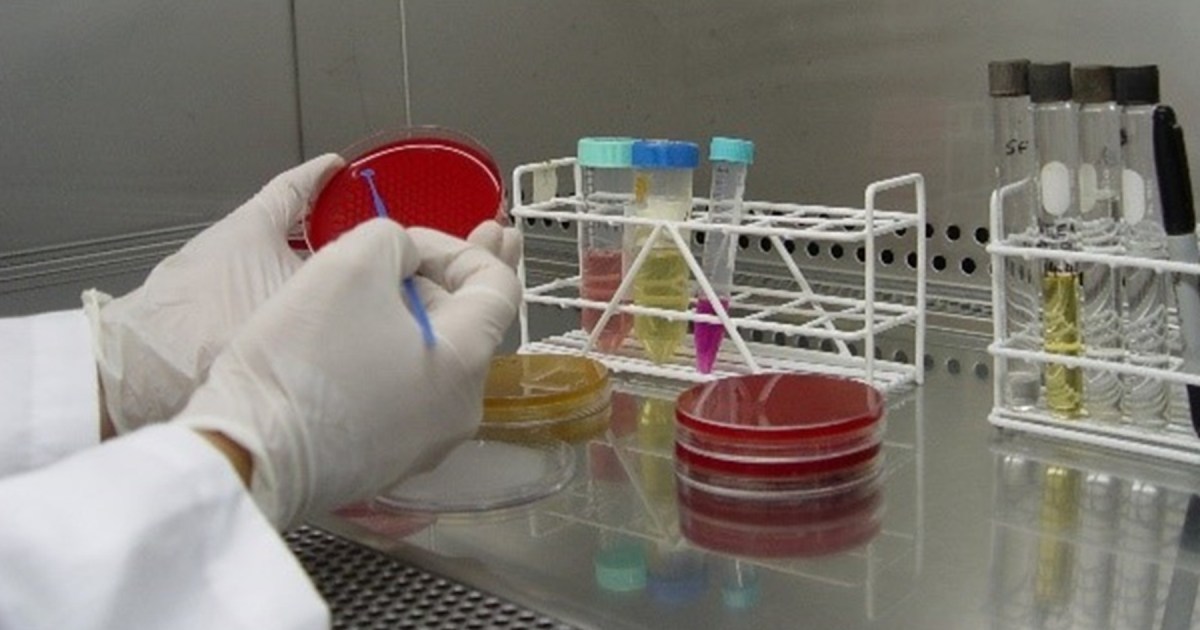 Conservación de recursos genéticos microbianos y su biodiversidad