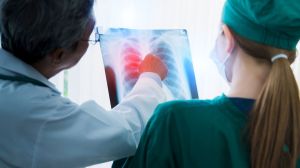Cáncer de pulmón: una combinación de fármacos retrasa el empeoramiento de síntomas