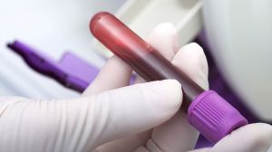 ¿Hay que hacerse un análisis de vitamina D cada año?