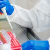Imagen de Científicas prueban cómo el ARN bacteriano puede ayudar a combatir tumores