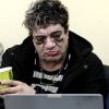 Imagen de Después del choque, Pity Álvarez tuvo que ser internado: cuál es su estado de salud y qué pasa con el juicio