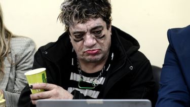 Después del choque, Pity Álvarez tuvo que ser internado: cuál es su estado de salud y qué pasa con el juicio