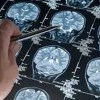 Imagen de Día Mundial del Alzheimer: qué es la reserva cognitiva y cómo puede fortalecerse