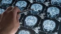 Imagen de Día Mundial del Alzheimer: qué es la reserva cognitiva y cómo puede fortalecerse