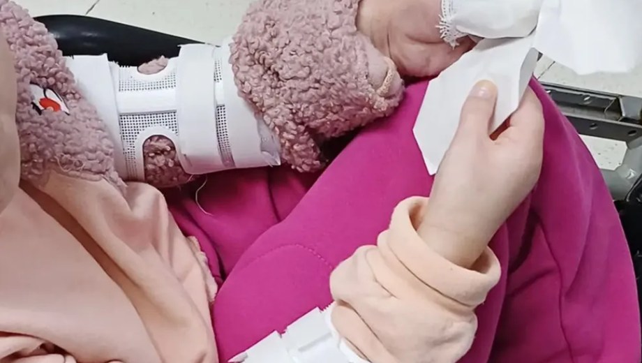 Una niña de 12 años recibió las férulas para hechas en 3 D en el hospital de Cutral Co (Foto: gentileza)