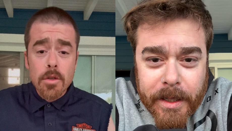 Migue Granados habló de su cambio físico en redes.