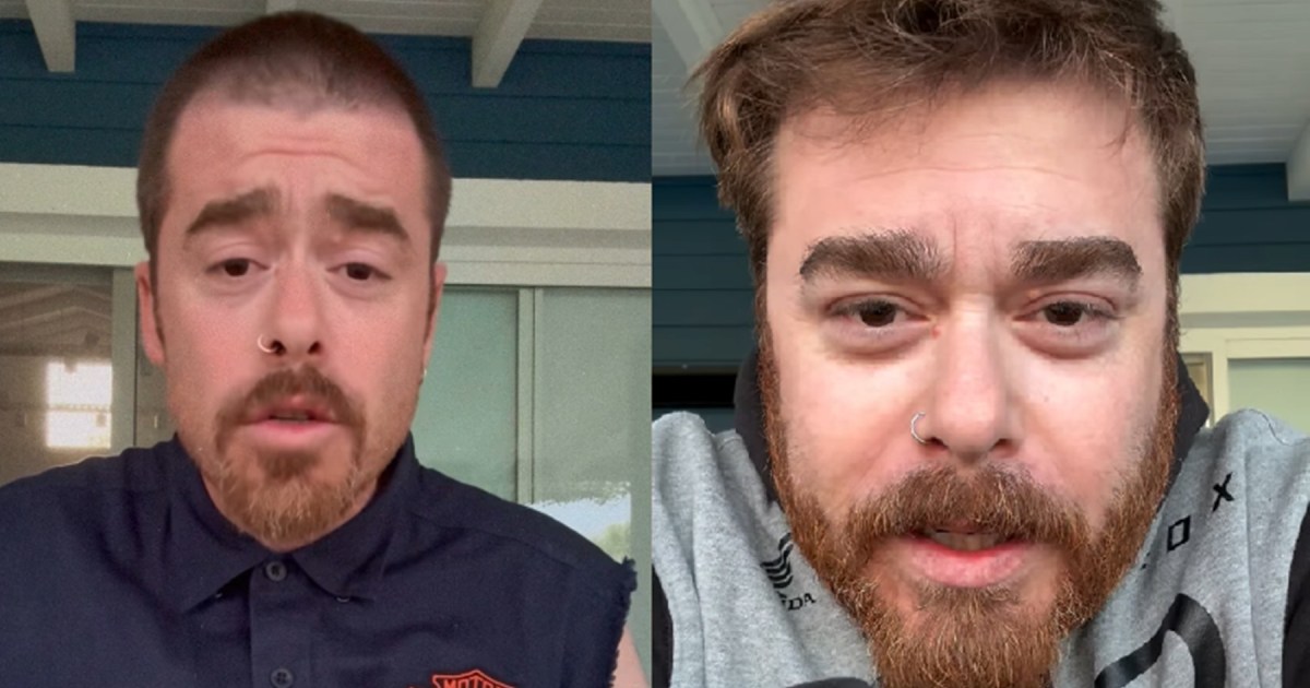 Migue Granados comparte su transformación: perdió 20 kilos a los 40 años