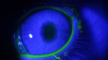 Imagen de ¿Chau a las gotas? Científicos argentinos crean un minidispositivo 3D contra el glaucoma