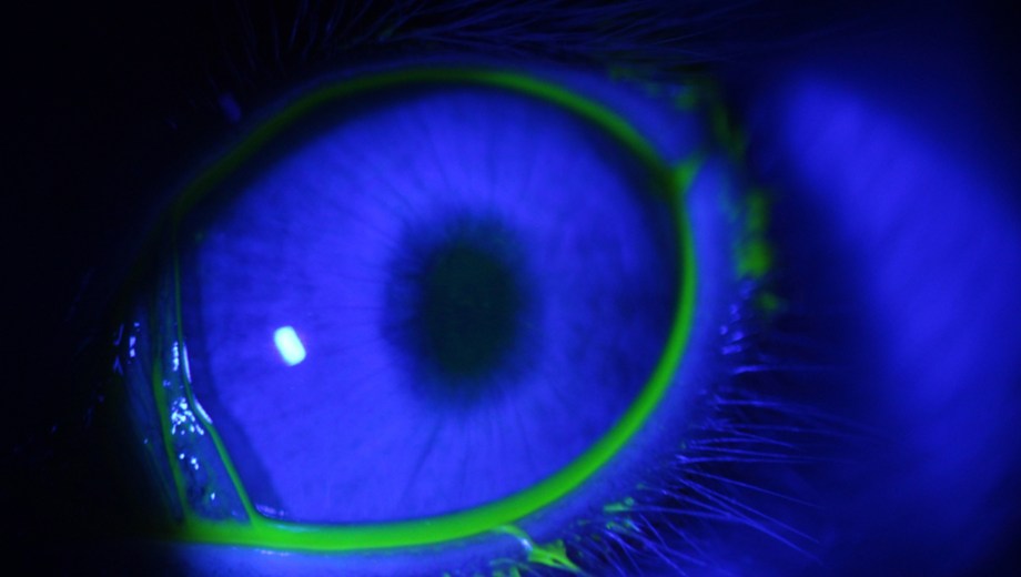 El dispositivo para prevenir el glaucoma aún debe pasar otras etapas para llegar hasta los pacientes. (Gentileza Conicet).