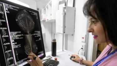 Mamografías gratis y sin orden médica en Río Negro: en qué hospitales y cómo sacar turno
