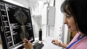 Cáncer de mama en Río Negro: cómo hacerse la mamografía gratis y todo lo que hay que saber